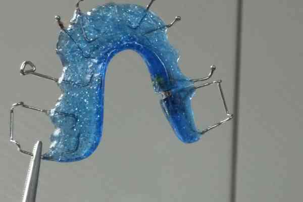 Das Gehalt als Kieferorthopäde - aktuelle Zahlen aus 2025